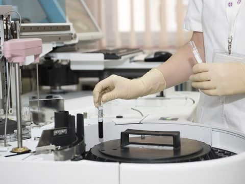 COVID-19: DES CHERCHEURS QUÉBÉCOIS TRAVAILLENT SUR UN TEST DE DÉPISTAGE PLUS RAPIDE