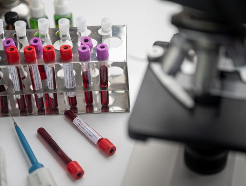 UN VACCIN SINO-CANADIEN CONTRE LA COVID-19