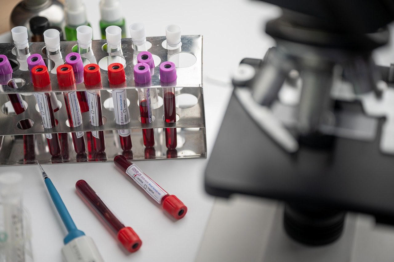 UN VACCIN SINO-CANADIEN CONTRE LA COVID-19