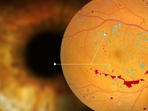 Diagnos reçoit 2M$ de la part de Québéc