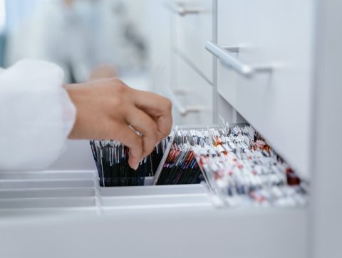 [ÉDITORIAL] Libérer les données personnelles en Santé, pas à n’importe quel prix