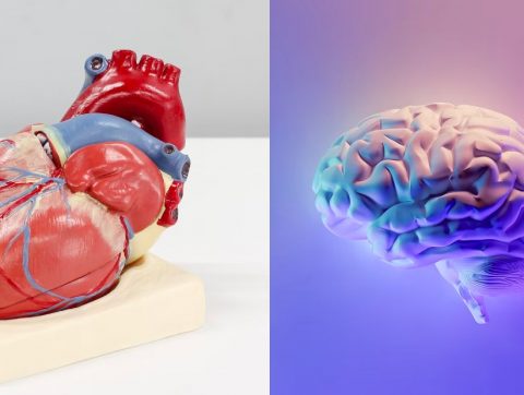 L’IA pour prévenir les risques d’AVC