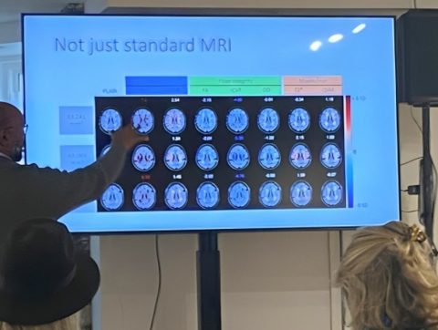 Recherche et innovation en neurosciences : un progrès porteur d&rsquo;espoir pour les patients